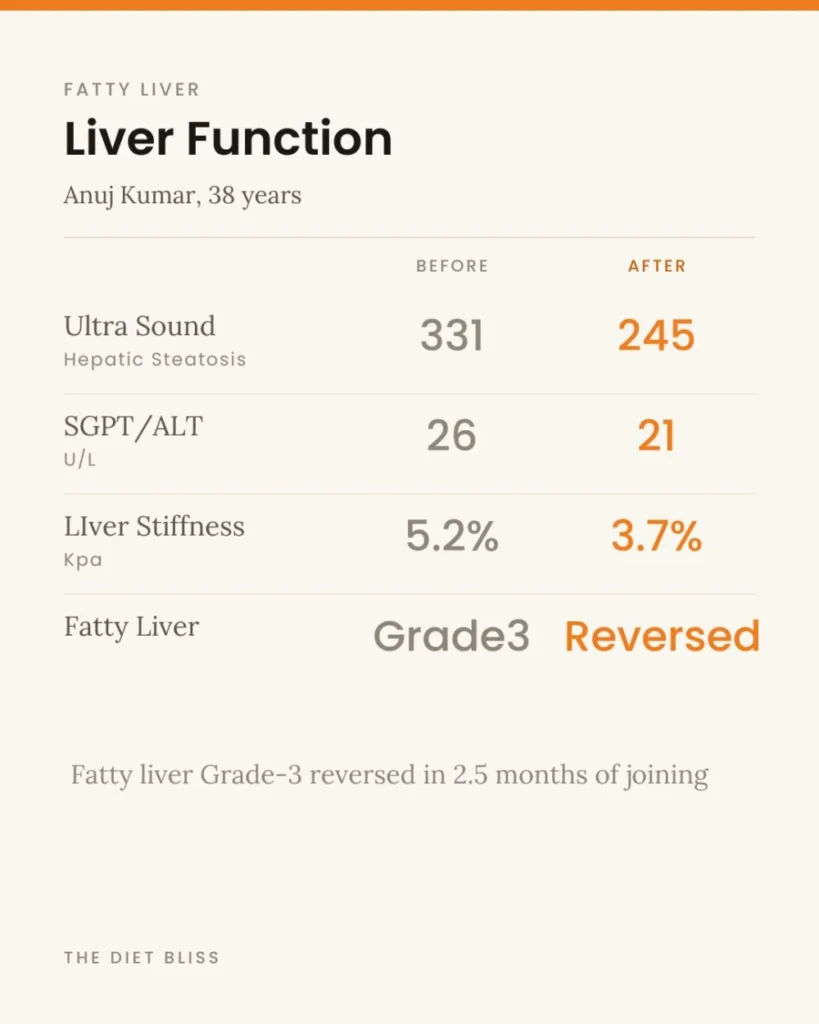 Anuj Kumar – grade 3 fatty liver reversed