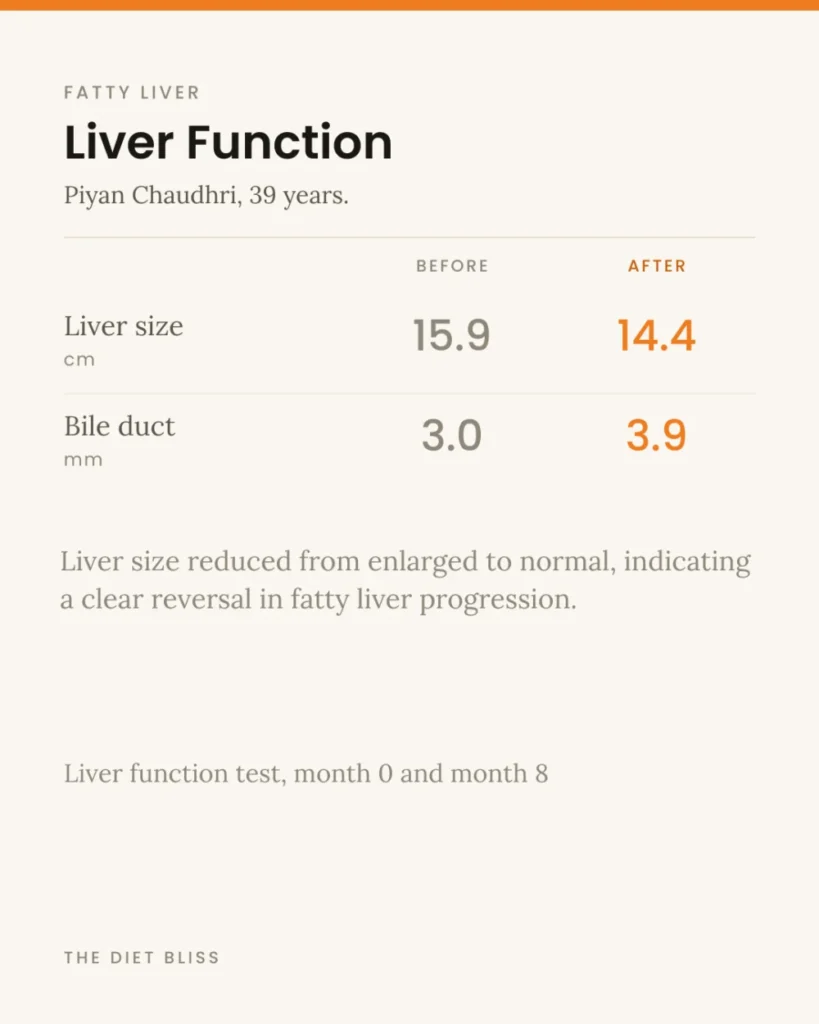 Piyan Chaudhuri – fatty liver