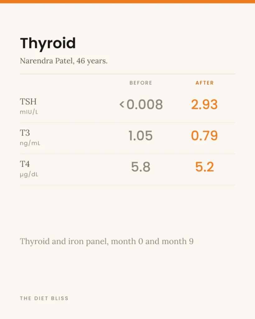 Sunita Mundhra – thyroid health - before and after report