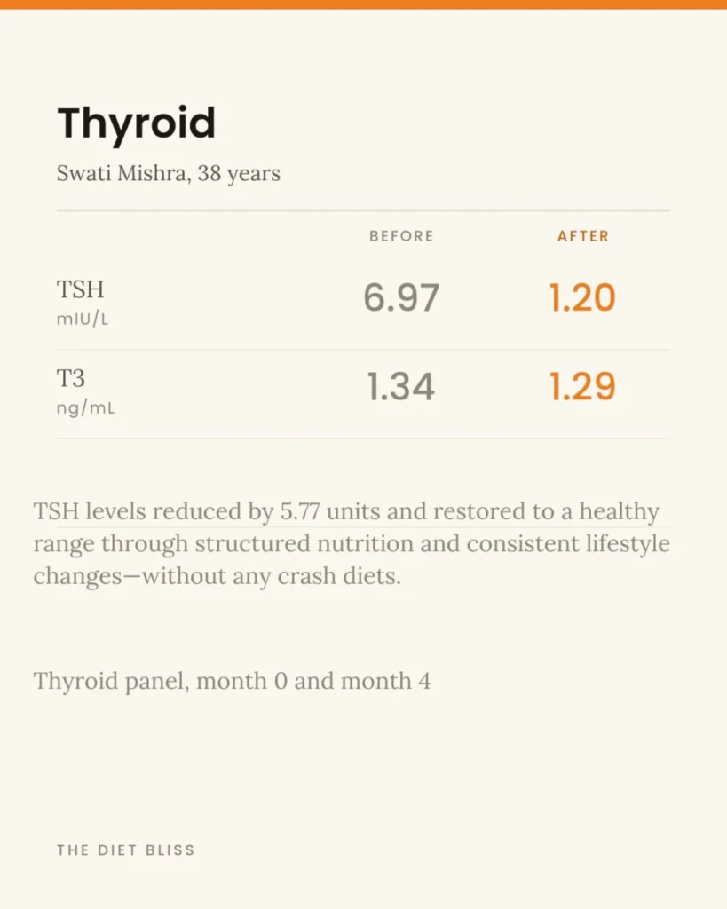 Swati Mishra – thyroid concern - before and after report